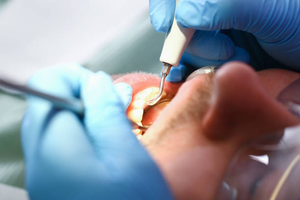 Best Emergency Root Canal Treatment in Grantville, GA