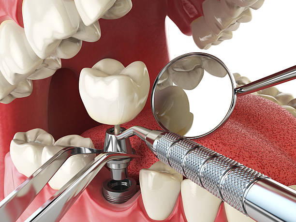 Best Emergency Dental Care for Abscessed Tooth in Grantville, GA